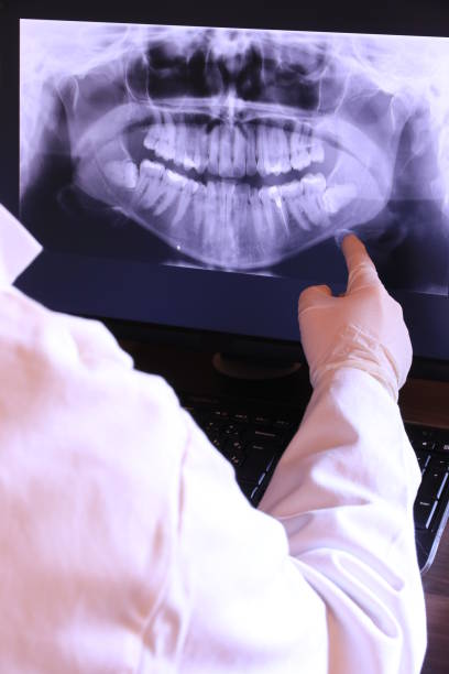 Emergency Dental Filling Replacement in TX